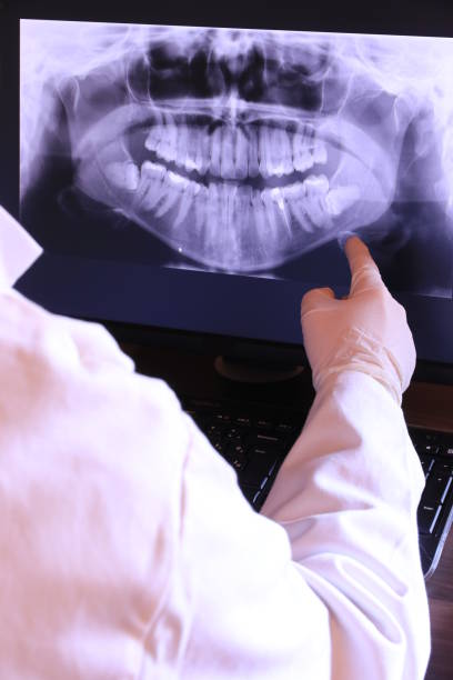 Best Emergency Tooth Extraction in Wentworth, NC