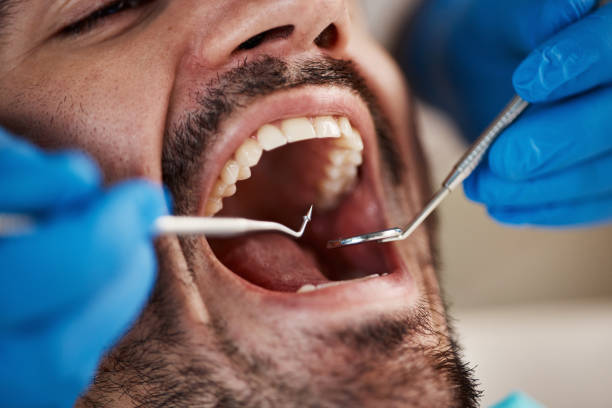 Best Emergency Treatment for Toothache in Wentworth, NC