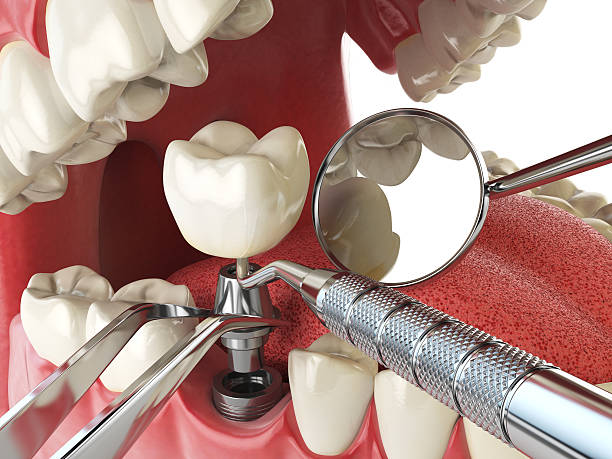 Best After-Hours Emergency Dentist in Wentworth, NC